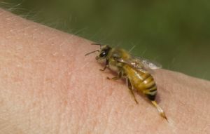 Honey bee Venom